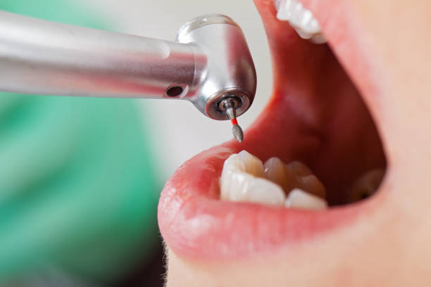 Best Root Canal Emergency Dentist  in Montpelier, ID